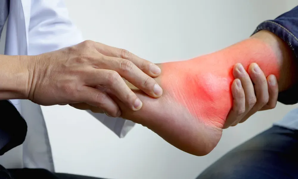 Gout: A Comprehensive Guide to Understanding and Managing the Condition